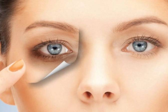 وصفات طبيعية للتخلص من الهالات السوداء حول العينين