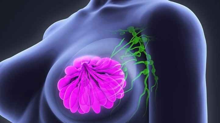 سرطان الثدي أسبابه وأعراضه وطرق الوقاية منه