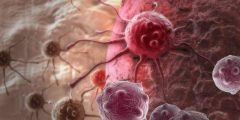 هل مرض السرطان وراثي